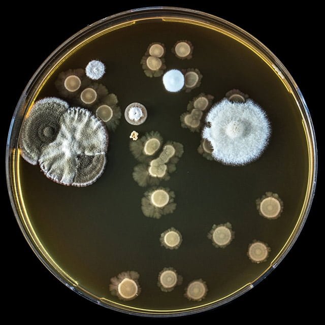 nấm Blastomyces dermatitidis