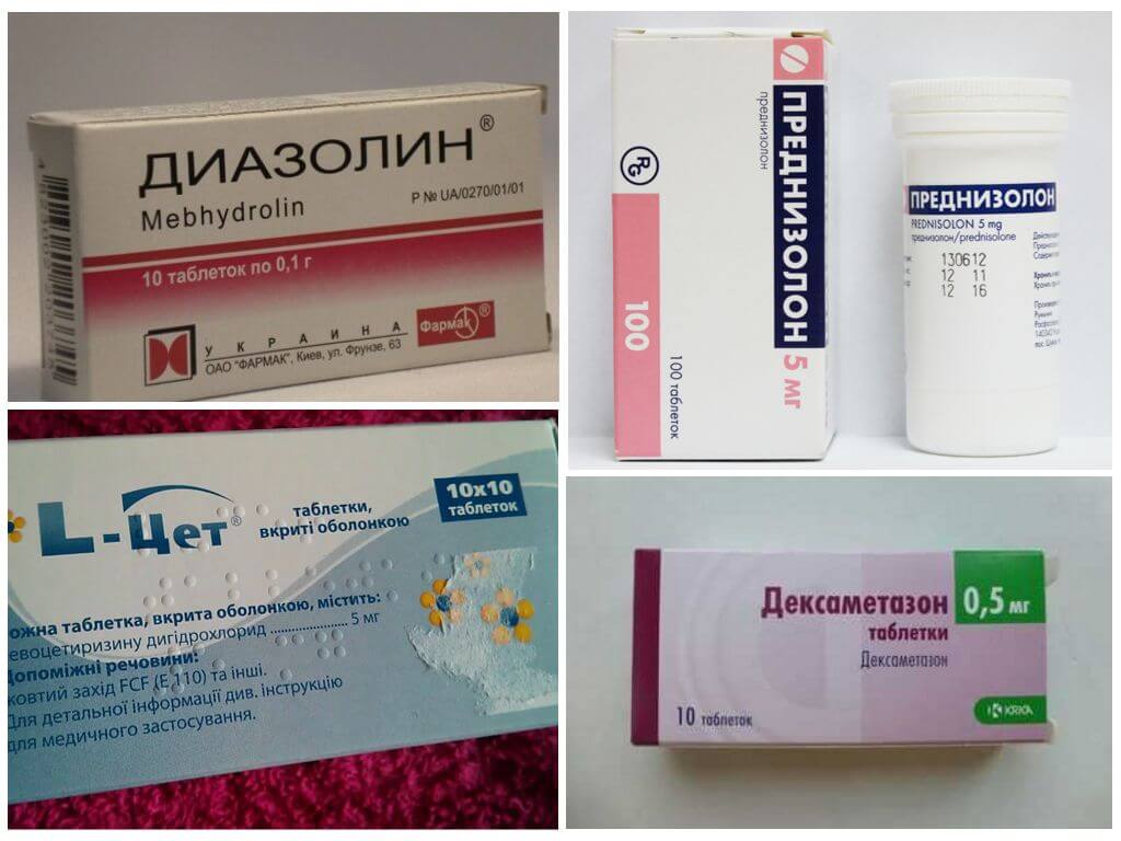 Thuốc kháng histamine